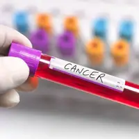چرا برخی سرطان‌ها بعد از درمان عود می‌کنند؟