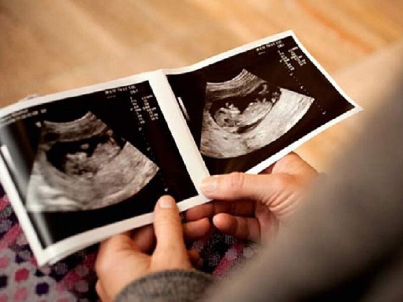 مشاوره مناسب، 35 مادر باردار در کاشان را از سقط جنین منصرف کرد