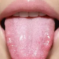 اهمیت درمان زخم‌های زبان