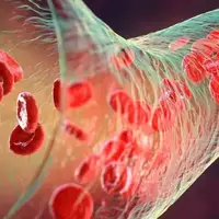 میکروپلاستیک‌ها به لخته‌های خونی قلب، مغز و پاهایمان نفوذ کرده‌اند