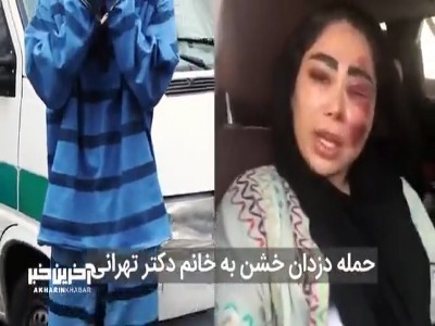 حمله خونین دزدان خشن به خانم دکتر تهرانی 
