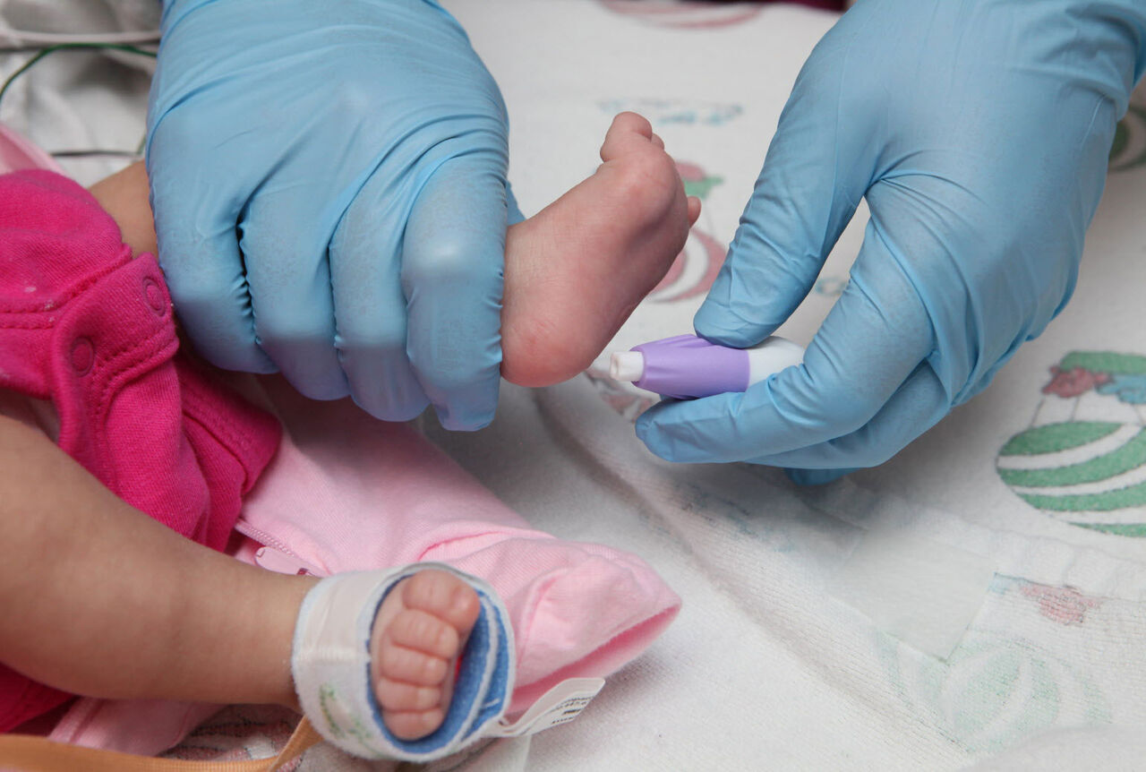 شناسایی سالانه 75 نوزاد مبتلا به تیروئید در خراسان جنوبی