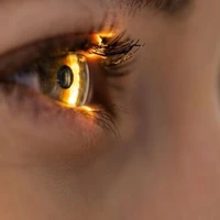 علم لیزیک چشم چطور انجام می شود؟