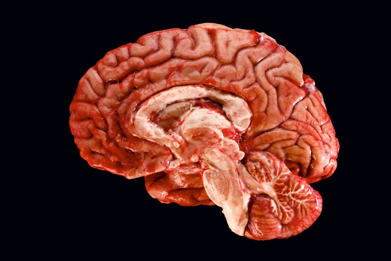 ثبت تصویر مغز انسان با وضوح بی‌سابقه