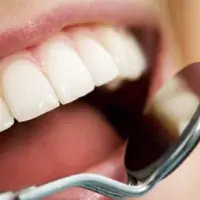 رفع پوسیدگی‌ها در مراحل ابتدایی بدون تراشیدن دندان با محصول دانش‌بنیان ایرانی