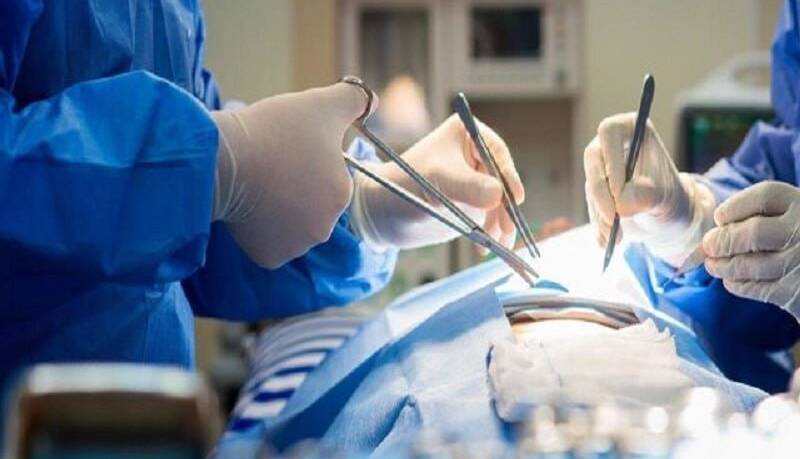 عمل جراحی مالتیپل اگسوزتوزیس در بیمارستان کوثر سنندج انجام شد