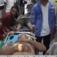 تصاویری از مجروحان یمنی در پی حمله رژیم صهیونیستی 