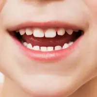 تأثیر آب نمک در پیشگیری از پوسیدگی دندان