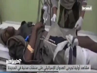 تصاویری از مجروحان یمنی درپی حمله رژیم صهیونیستی به بندر حدیده 