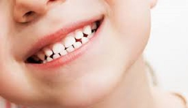 قطره آهن دندان را سیاه می کند؛ گول نخورید