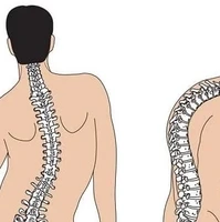 عوامل موثر در نتیجه درمان درد دیسک کمر هر شخص