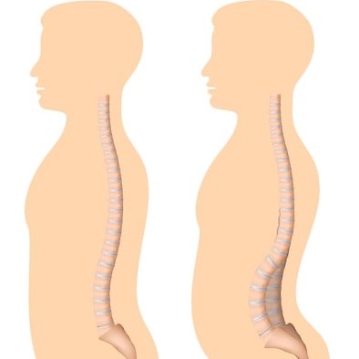 بهداشت ستون فقرات از نگاه طب سنتی