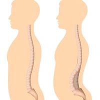 بهداشت ستون فقرات از نگاه طب سنتی