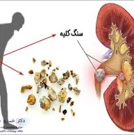 معجزه آب کرفس برای دفع سنگ کلیه