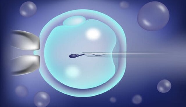 بهره‌برداری 15 مرکز درمان ناباروری از تراشه‌های جداساز اسپرم