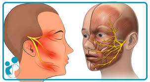 همه چیز درباره درد عصب سه قلو صورت