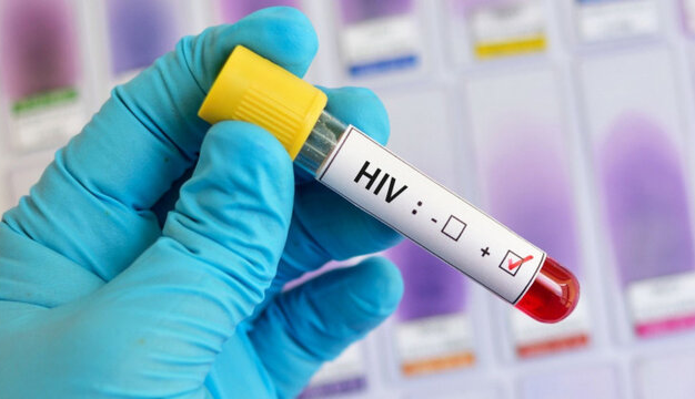 HIV؛ بیماری عفونی و قابل کنترل / تغییر الگوی انتقال HIV از اعتیاد تزریقی به روابط پرخطر