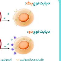 تفاوت دیابت نوع یک با دو