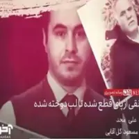 از پای قطع شده تا لب دوخته شده رونقی!