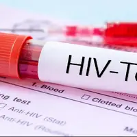 راه‌اندازی پایگاه‌های موقت و رایگان غربالگری تست HIV در لرستان