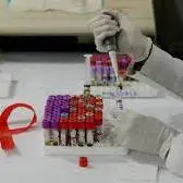 ۱۵ ایستگاه سلامت آماده انجام تست HIV در چهارمحال و بختیاری