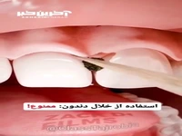 استفاده از خلال دندون ممنوع!