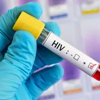 رویکرد وزارت بهداشت در شناسایی و درمان مبتلایان HIV 