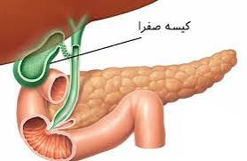 مراقبت‌های پس از جراحی کیسه صفرا