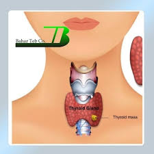 بهبود گره‌های تیروئیدی با چند راهکار طلایی