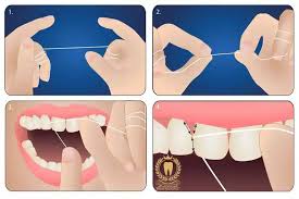 اهمیت استفاده صحیح از نخ دندان