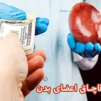 توضیحات یک نماینده درباره طرح مبارزه با قاچاق انسان و اعضای بدن