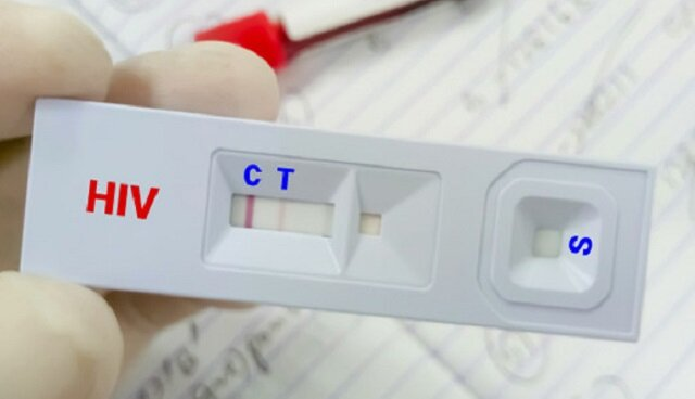 درمان «ایدز» رایگان است/ ویروس HIV قابل کنترل است به شرط درمان