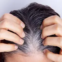 راهکار جلوگیری از خاکستری شدن موها