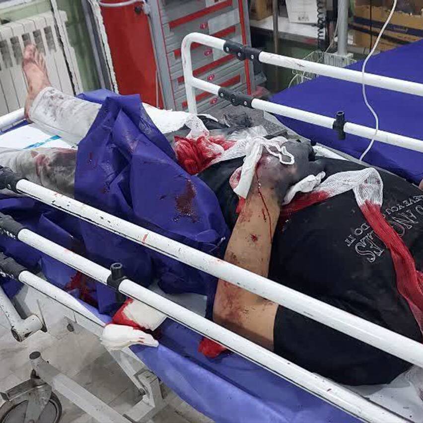 مصدومشدن ۱۹۵ نفر در حوادث چهارشنبهسوری استان اردبیل
