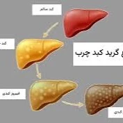 نوشیدن آب سرد باعث کبد چرب می‌شود؟