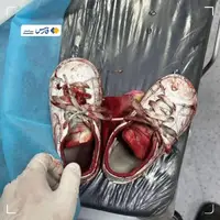 تعداد شهدای غزه از 50 هزار نفر عبور کرد