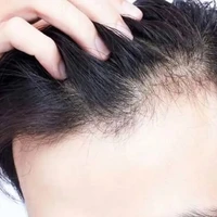 تضمین سلامت مو با مصرف این مواد غذایی
