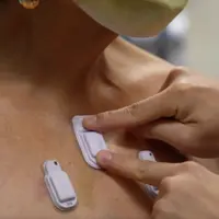 برچسب پزشکی سلامت ریه را مشخص می‌کند