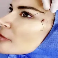 زیبایی روی بند نخ!