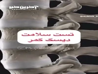 تست سلامت دیسک کمر