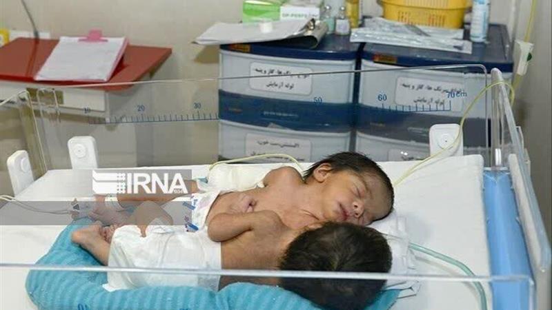 ثبت ۳۰ مورد تولد نوزاد دوقلو در البرز
