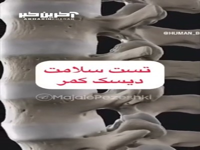 تست سلامت دیسک کمر