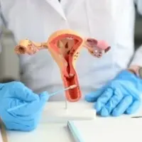 سندروم تخمدان پلی کیستیک را چگونه می‌توان تشخیص داد؟ 