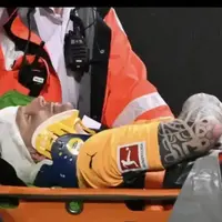 دروازه‌بان معروف در زمین ضربه مغزی شد!