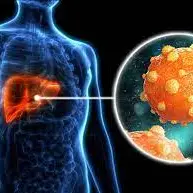هپاتیت نوع C چیست و چگونه درمان می‌شود؟ 