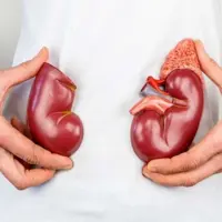 رعایت اصول تغذیه، پیشگیری از سرطان کلیه با سبک زندگی سالم