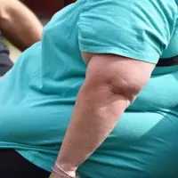 ارتباط چاقی با مشکلات ریوی