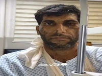 بینایی یکی از کارگران حادثه‌دیده بندر شهید رجایی بازگشت