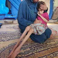 عکس/ گرسنگی و محاصره ظالمانه غزه توسط رژیم صهیونیستی 