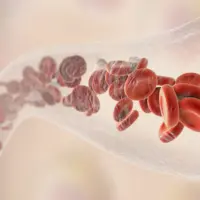 آیا بیماری تالاسمی علائمی دارد؟ 